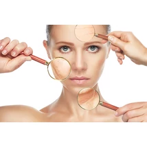 Photorejuvenáció kezelés